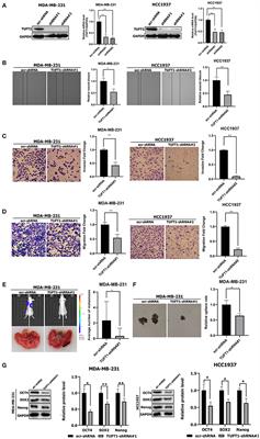 TUFT1 Promotes Triple Negative Breast Cancer Metastasis, Stemness, and Chemoresistance by Up-Regulating the Rac1/β-Catenin Pathway